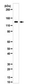 Anti-ATP-citrate synthase/ACLY Antibody from rabbit, purified by affinity chromatography