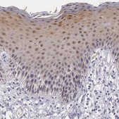 Anti-IL1RN antibody produced in rabbit Prestige Antibodies&#174; Powered by Atlas Antibodies, affinity isolated antibody, buffered aqueous glycerol solution