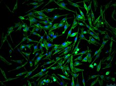 OSUMMER.2 Mouse NRAS-Mutant Melanoma Cell Line