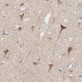 Anti-OPTN antibody produced in rabbit Ab2, Prestige Antibodies&#174; Powered by Atlas Antibodies, affinity isolated antibody, buffered aqueous glycerol solution