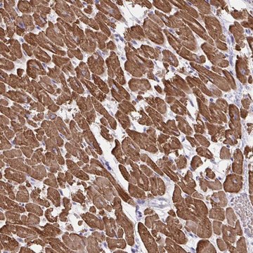 Anti-KIAA1161 antibody produced in rabbit Prestige Antibodies&#174; Powered by Atlas Antibodies, affinity isolated antibody, buffered aqueous glycerol solution