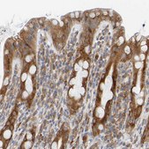 Anti-SIL1 antibody produced in rabbit Prestige Antibodies&#174; Powered by Atlas Antibodies, affinity isolated antibody, buffered aqueous glycerol solution