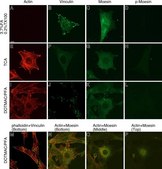 Monoclonal Anti-&#946;-Actin antibody produced in mouse clone AC-15, ascites fluid