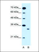 Anti-SLC25A22 antibody produced in rabbit IgG fraction of antiserum