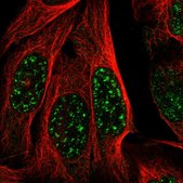 Anti-MAST3 antibody produced in rabbit Prestige Antibodies&#174; Powered by Atlas Antibodies, affinity isolated antibody, buffered aqueous glycerol solution