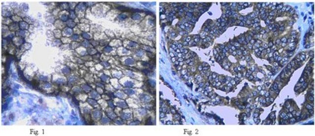 Anti-Neutral amino acid transporter (ASCT2) Antibody from rabbit, purified by affinity chromatography