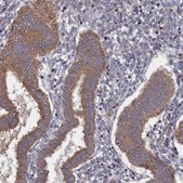 Anti-FILIP1L antibody produced in rabbit Prestige Antibodies&#174; Powered by Atlas Antibodies, affinity isolated antibody, buffered aqueous glycerol solution