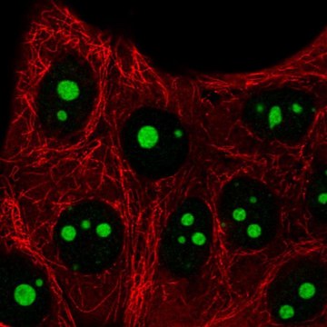 Anti-SETMAR antibody produced in rabbit Prestige Antibodies&#174; Powered by Atlas Antibodies, affinity isolated antibody