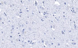 Anti-Histone H2B Antibody, clone 4O11 ZooMAb&#174; Rabbit Monoclonal recombinant, expressed in HEK 293 cells