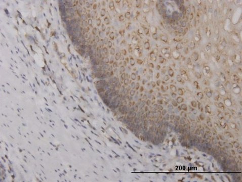 Monoclonal Anti-RPS2 antibody produced in mouse clone 3G6, purified immunoglobulin, buffered aqueous solution