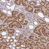 Anti-CYP27A1 antibody produced in rabbit Prestige Antibodies&#174; Powered by Atlas Antibodies, affinity isolated antibody, buffered aqueous glycerol solution