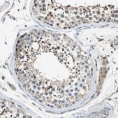 Anti-MAGI2 antibody produced in rabbit Prestige Antibodies&#174; Powered by Atlas Antibodies, affinity isolated antibody, buffered aqueous glycerol solution
