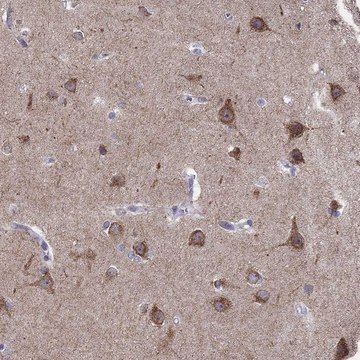 Anti-LMTK3 Prestige Antibodies&#174; Powered by Atlas Antibodies, affinity isolated antibody