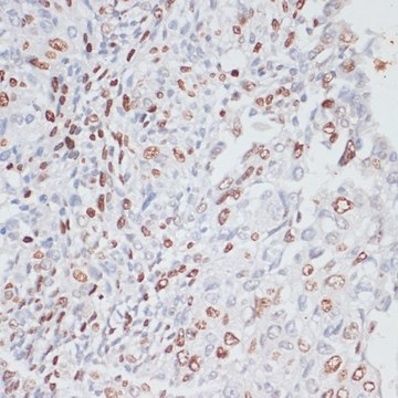 Anti-Ki67 antibody produced in rabbit