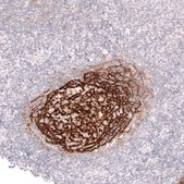 Monoclonal Anti-Cr2 Antibody Produced In Mouse Prestige Antibodies&#174; Powered by Atlas Antibodies, clone CL14552, affinity isolated antibody, buffered aqueous glycerol solution