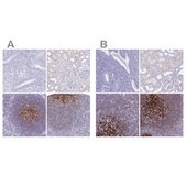 Anti-CR2 antibody produced in rabbit Prestige Antibodies&#174; Powered by Atlas Antibodies, affinity isolated antibody, buffered aqueous glycerol solution