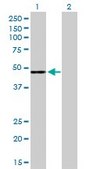 Anti-CFH antibody produced in rabbit purified immunoglobulin, buffered aqueous solution