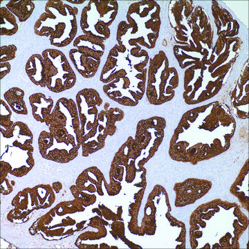 PSA (ER-PR8) Mouse Monoclonal Antibody