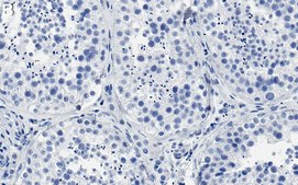 Anti-Drosha Antibody, clone 1B19 ZooMAb&#174; Rabbit Monoclonal recombinant, expressed in HEK 293 cells