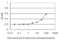 Monoclonal Anti-RPS6 antibody produced in mouse clone 3H1-F2, purified immunoglobulin, buffered aqueous solution