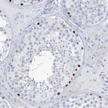 Anti-SLC35A5 antibody produced in rabbit Prestige Antibodies&#174; Powered by Atlas Antibodies, affinity isolated antibody, buffered aqueous glycerol solution