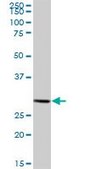 Anti-HIBADH antibody produced in mouse IgG fraction of antiserum, buffered aqueous solution