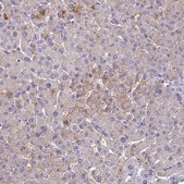 Anti-SLC13A5 antibody produced in rabbit Prestige Antibodies&#174; Powered by Atlas Antibodies, affinity isolated antibody, buffered aqueous glycerol solution