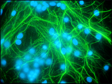 Anti-Neurofilament 200 antibody produced in rabbit IgG fraction of antiserum, buffered aqueous solution
