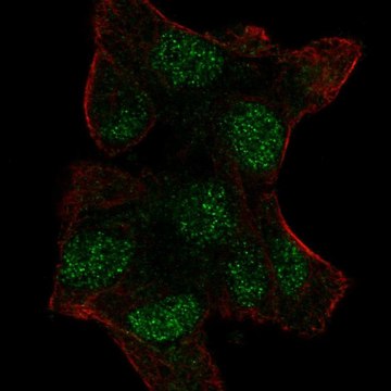 Anti-UBE2V1 antibody produced in rabbit Prestige Antibodies&#174; Powered by Atlas Antibodies, affinity isolated antibody