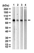 Anti-Arylsulfatase A Antibody, clone 2C19 ZooMAb&#174; Rabbit Monoclonal recombinant, expressed in HEK 293 cells