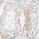 Anti-PLOD3 antibody produced in rabbit Prestige Antibodies&#174; Powered by Atlas Antibodies, affinity isolated antibody, buffered aqueous glycerol solution
