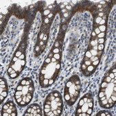 Anti-CLDN7 antibody produced in rabbit Prestige Antibodies&#174; Powered by Atlas Antibodies, affinity isolated antibody, buffered aqueous glycerol solution