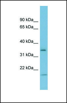 Anti-IGFBP2 antibody produced in rabbit affinity isolated antibody