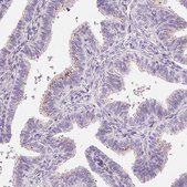 Anti-CHST4 antibody produced in rabbit Prestige Antibodies&#174; Powered by Atlas Antibodies, affinity isolated antibody, buffered aqueous glycerol solution