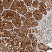 Anti-ALDH1L1 antibody produced in rabbit Prestige Antibodies&#174; Powered by Atlas Antibodies, affinity isolated antibody, buffered aqueous glycerol solution