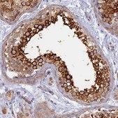 Anti-WDR62 antibody produced in rabbit Prestige Antibodies&#174; Powered by Atlas Antibodies, affinity isolated antibody, buffered aqueous glycerol solution