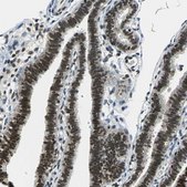 Anti-RBM14 antibody produced in rabbit Prestige Antibodies&#174; Powered by Atlas Antibodies, affinity isolated antibody, buffered aqueous glycerol solution