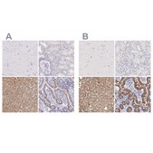 Anti-OTC antibody produced in rabbit Ab2, Prestige Antibodies&#174; Powered by Atlas Antibodies, affinity isolated antibody, buffered aqueous glycerol solution