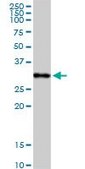 Anti-C1QA antibody produced in rabbit purified immunoglobulin, buffered aqueous solution