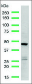 Anti-CD16A antibody, Rabbit monoclonal recombinant, expressed in proprietary host, clone SP189, affinity isolated antibody