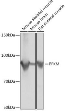 Anti-PFKM Antibody, clone 4Z7X1, Rabbit Monoclonal