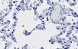 Anti-ACE2-cytoplasmic Antibody, clone 1C17 ZooMAb&#174; Rabbit Monoclonal recombinant, expressed in HEK 293 cells