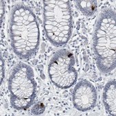 Anti-PYY antibody produced in rabbit Prestige Antibodies&#174; Powered by Atlas Antibodies, affinity isolated antibody, buffered aqueous glycerol solution