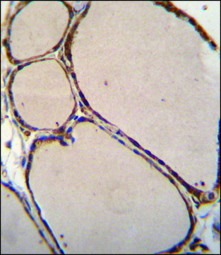 ANTI-NFKBID (N-TERM) antibody produced in rabbit IgG fraction of antiserum, buffered aqueous solution