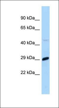 Anti-MXD1 antibody produced in rabbit affinity isolated antibody