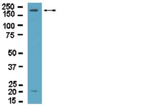 Anti-Dock2 Antibody from rabbit, purified by affinity chromatography