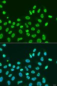 Anti- HP1 alpha/CBX5 antibody produced in rabbit