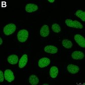Anti-ZEB1 Antibody, clone 5C20 ZooMAb&#174; Rabbit Monoclonal recombinant, expressed in HEK 293 cells