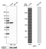 Anti-G6PD antibody produced in rabbit Ab2, Prestige Antibodies&#174; Powered by Atlas Antibodies, affinity isolated antibody, buffered aqueous glycerol solution