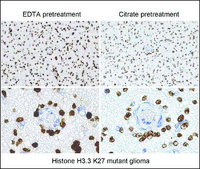 Anti-Histone H3 K27M antibody, Rabbit Monoclonal recombinant, expressed in HEK 293 cells, clone RM192, purified immunoglobulin